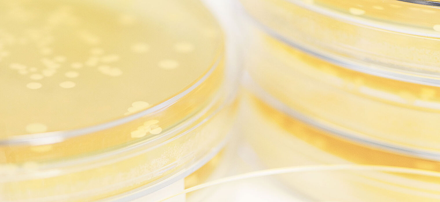 Close-up of stacked petri dishes with yellow agar medium, showing bacterial colonies growing on the surface.